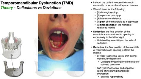 tmj compression test|tmj deviation vs deflection.